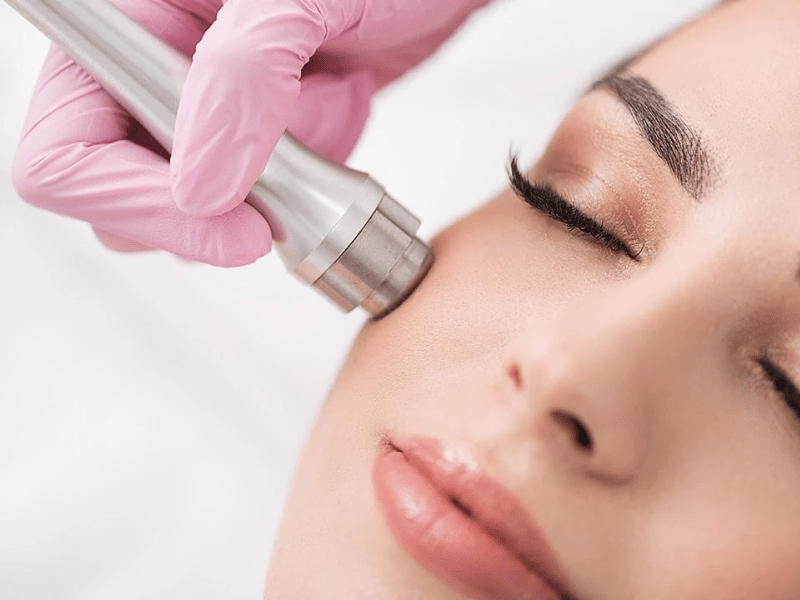 Microdermabrasion in Dubai